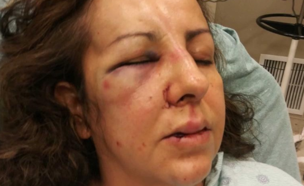 California Mom Gets Beaten By Her Daughter's Bullies